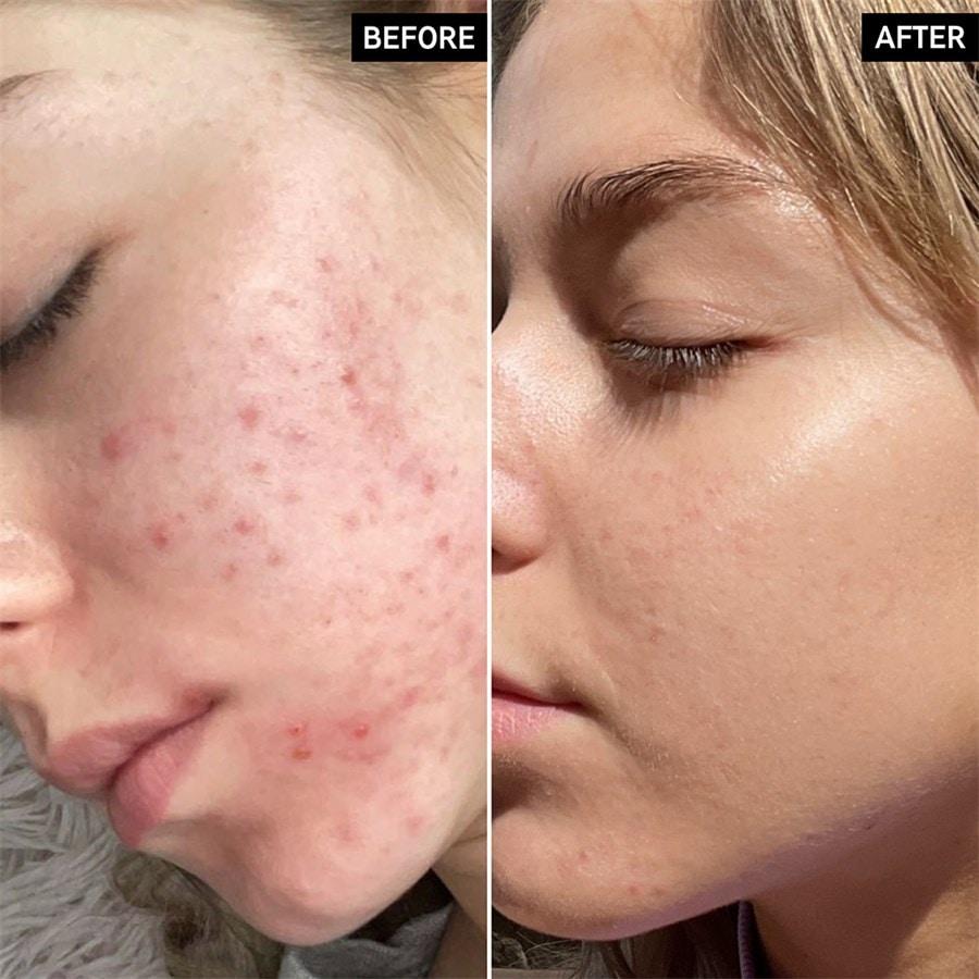 The INKEY List Sieri Niacinamide Serum Only for today